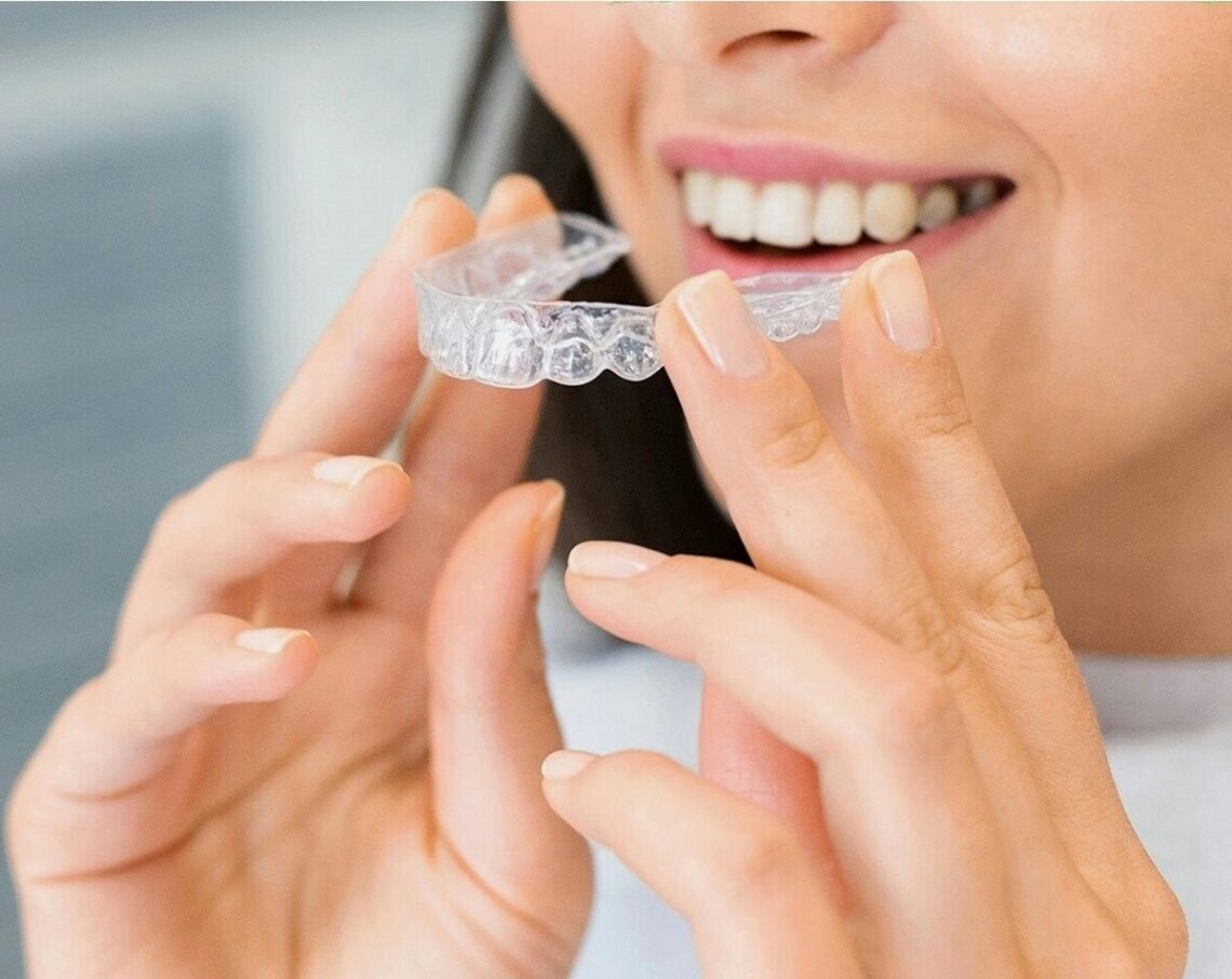 aparat dentar invisalign